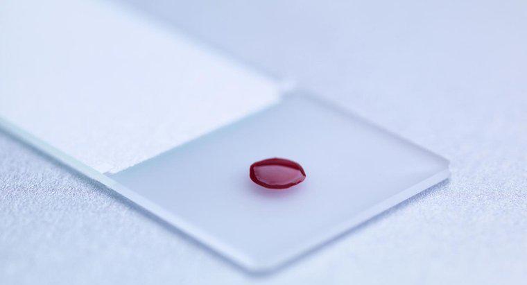 Xét nghiệm máu LDH là gì?