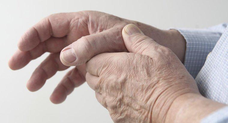 Phương pháp điều trị tốt nhất để giúp bàn tay bị viêm khớp là gì?