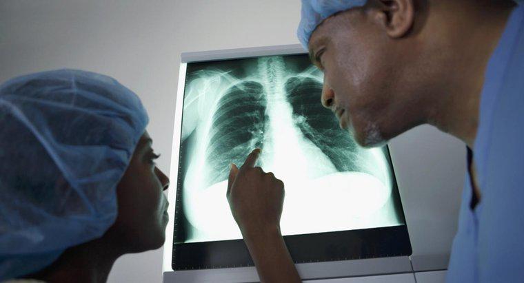 Dày màng phổi đỉnh là gì?