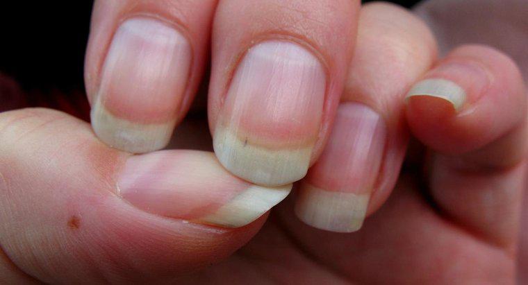 Nguyên nhân nào gây ra các vết nứt trên móng tay?