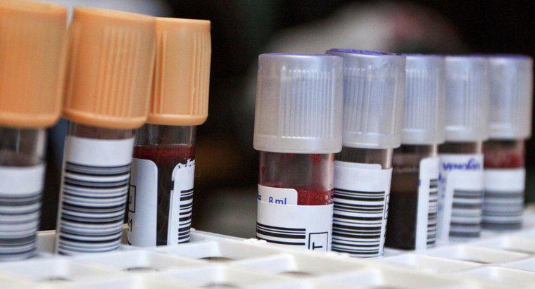 Xét nghiệm máu bạch cầu trung tính là gì?