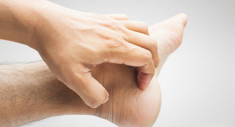 Nguyên nhân nào gây ngứa bàn tay và bàn chân?