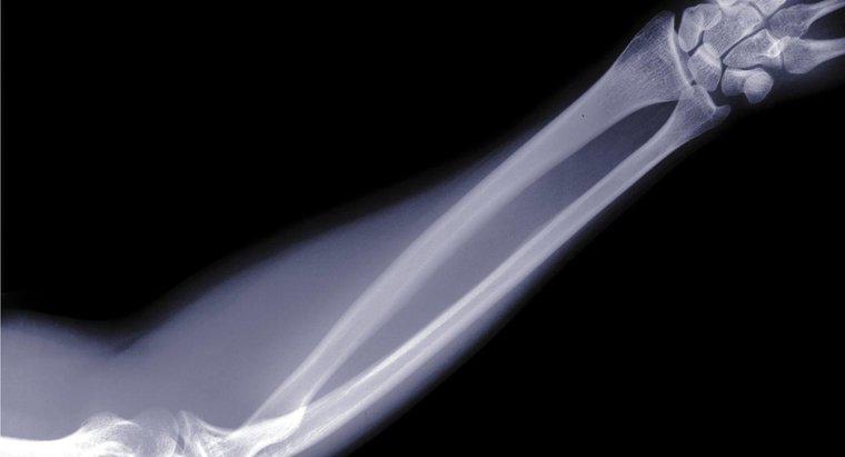 Tên của các xương trong cánh tay con người là gì?