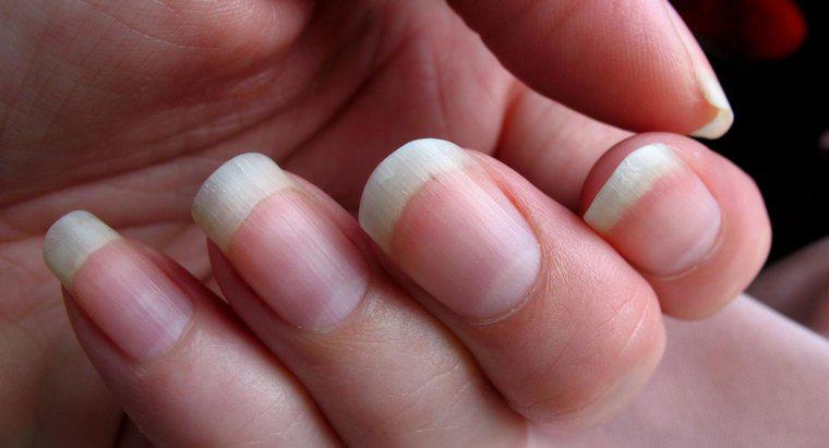 Cách tốt nhất để loại bỏ vết dằm sâu dưới móng tay là gì?