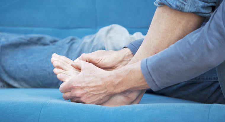 Cách điều trị Sưng bàn chân Tại nhà Tốt là gì?