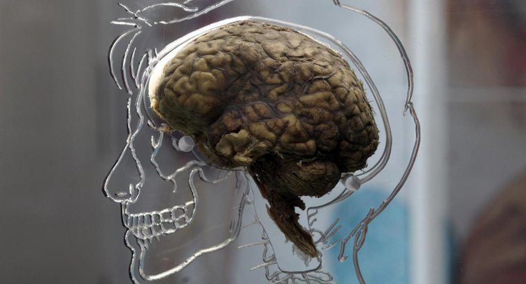 Các triệu chứng của một tổn thương não là gì?