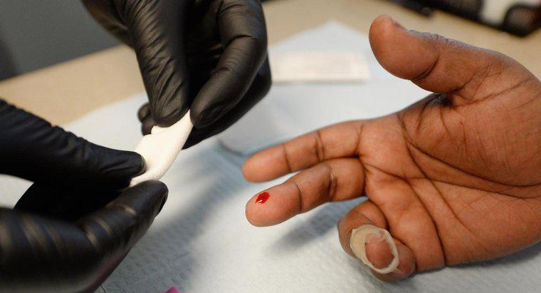 Mất bao lâu để HIV xuất hiện trên các xét nghiệm?