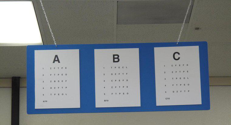 Biểu đồ mắt DMV là gì?