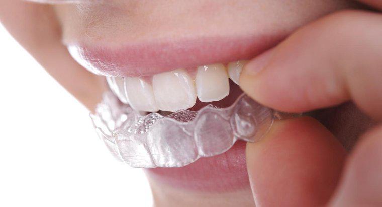 Làm Thế Nào Để Bạn Làm Thẳng Răng Mà Không Cần Niềng Răng?