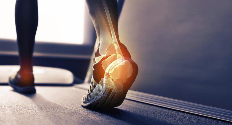 Nguyên nhân nào gây ra xương trên gót chân của bạn?