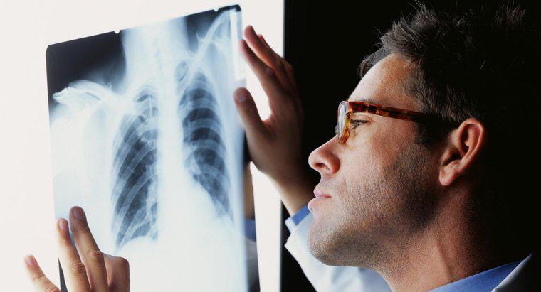 Nhiễm trùng phổi được điều trị như thế nào?