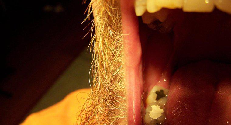 Làm thế nào để bạn thực hiện một trám răng tự chế?