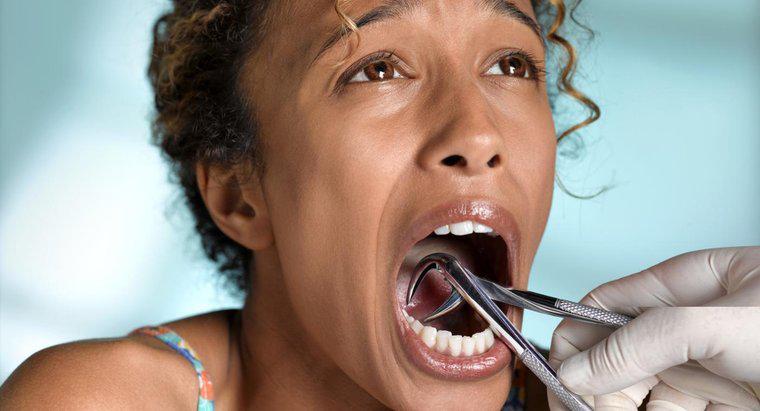 Làm thế nào để bạn điều trị nhiễm trùng sau khi nhổ răng?
