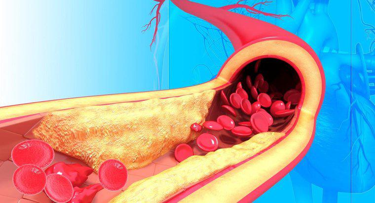 Cấu trúc của động mạch là gì?