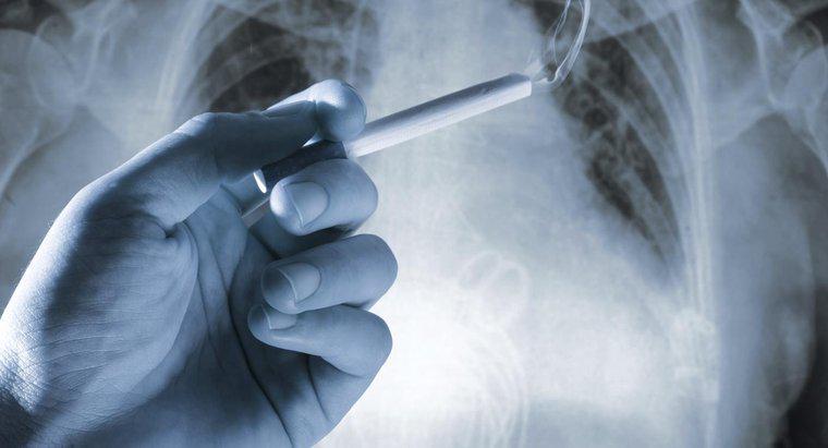 Một số triệu chứng của ung thư phổi là gì?