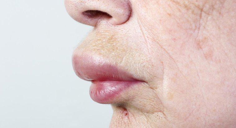 Làm thế nào để bạn chữa lành môi và mặt bị sưng?