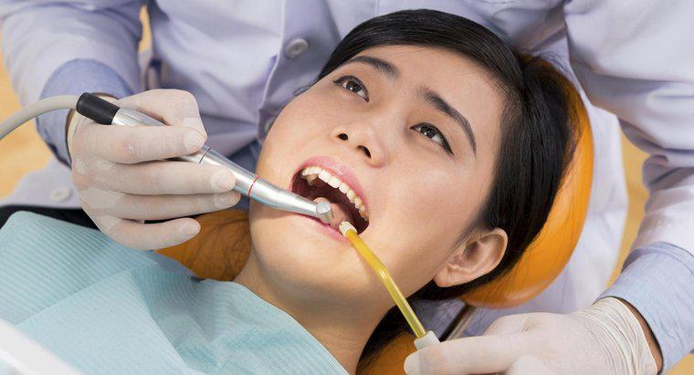 Làm thế nào để bạn khắc phục một chiếc răng thưa?