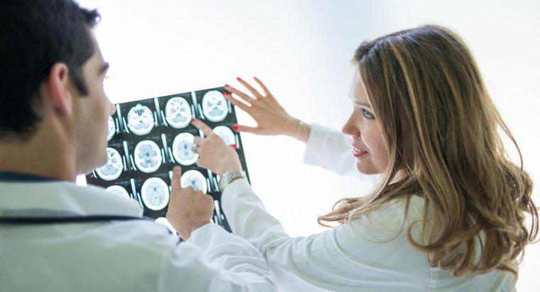 Một số triệu chứng của khối u não là gì?