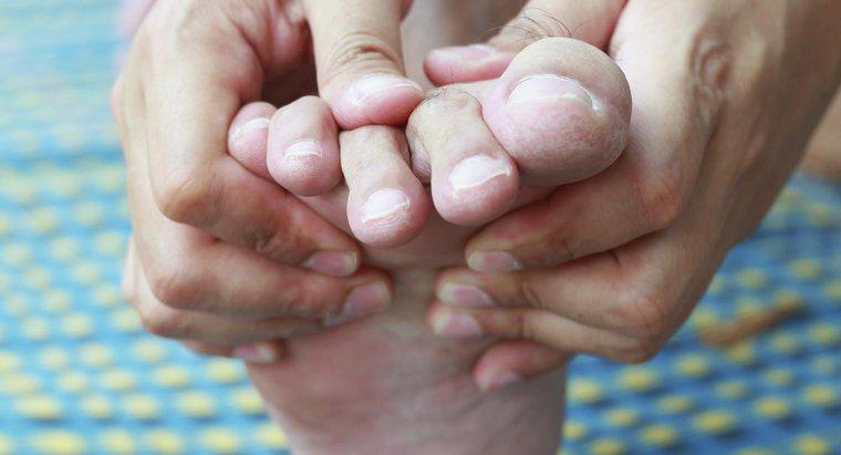 Làm thế nào để bạn giảm đau từ bắp giữa ngón chân?