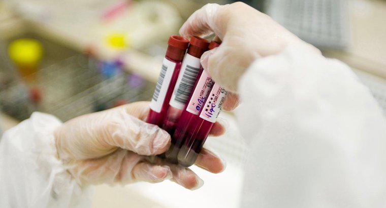Phạm vi bình thường cho mức CPK trong khi xét nghiệm máu là bao nhiêu?