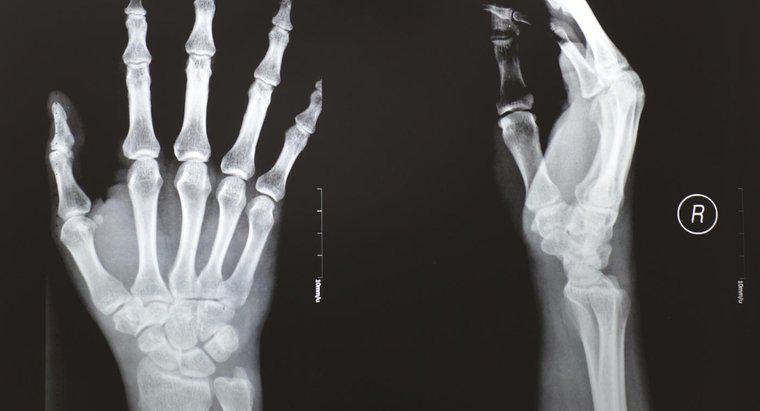 Các triệu chứng của một ngón tay cái bị gãy là gì?