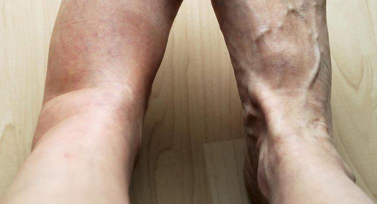 Một số nguyên nhân có thể gây ra đau và sưng ở chân trái của bạn là gì?