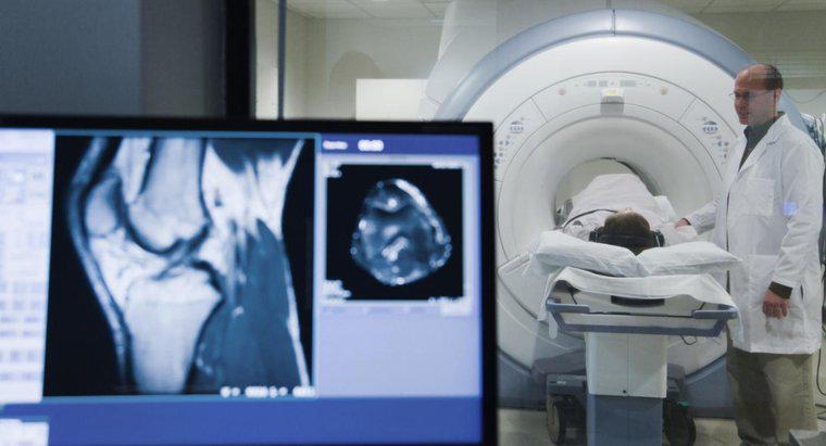 Chi phí trung bình cho chụp MRI trên đầu gối là bao nhiêu?