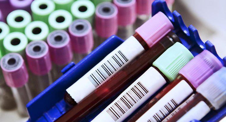 Viết tắt phổ biến trong xét nghiệm máu là gì?