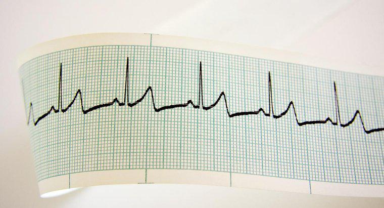 Điều gì gây ra nhịp tim nhanh?