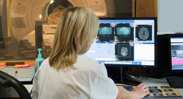 Một đốm trắng trên MRI não có nghĩa là gì?