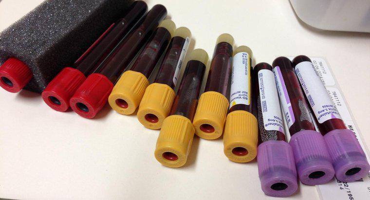 Mức Ferritin trong phép đo xét nghiệm máu là gì?