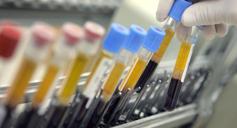 HCT trong xét nghiệm máu là gì?