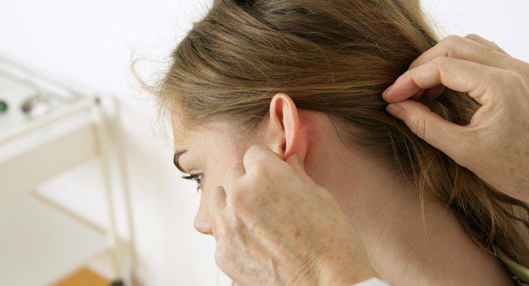 Các triệu chứng của nấm da đầu là gì?