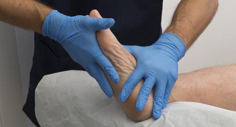 Một số nguyên nhân gây ra đau chân ở vùng vòm là gì?