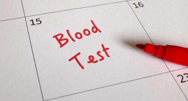 Xét nghiệm máu CA 125 là gì?