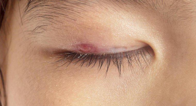 Có cách nào để ngăn ngừa hình thành nếp nhăn ở mắt không?