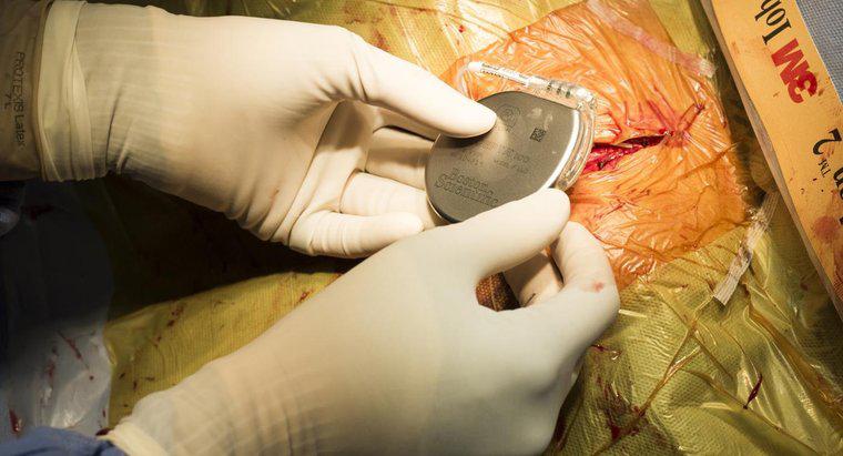 Quá trình phục hồi cho bệnh nhân phẫu thuật máy tạo nhịp tim là gì?