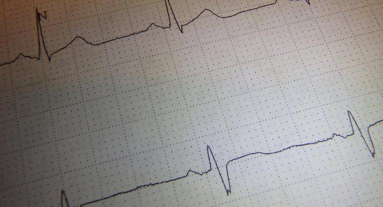 Phần nào của bộ não kiểm soát nhịp thở và nhịp tim?
