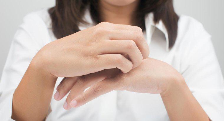 Điều gì gây ra phát ban ngứa trên bàn tay và bàn chân?