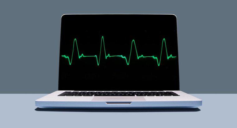 Có những phương pháp điều trị nào cho Nhịp tim nhanh?