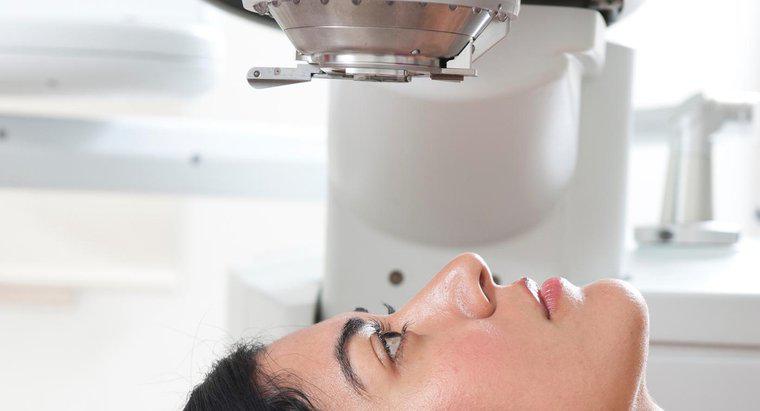 Điều trị bằng Laser Glaucoma là gì?