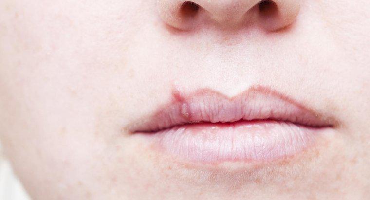 Dấu hiệu đầu tiên của ung thư môi là gì?