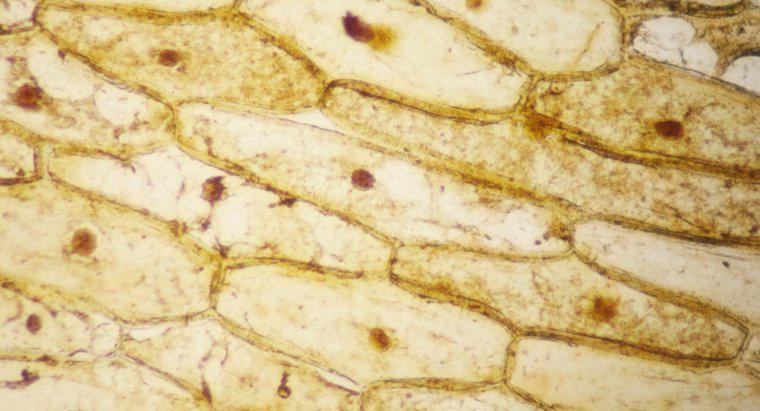 Tại sao vết bẩn iốt được sử dụng trên tế bào hành tây?