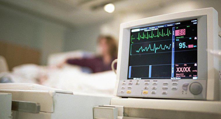 Bạn đọc các dải bài kiểm tra thực hành EKG như thế nào?