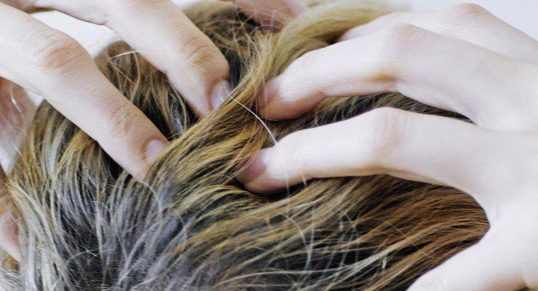 Nguyên nhân nào gây ngứa da đầu và rụng tóc?