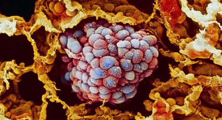 Tế bào tiền ung thư là gì?