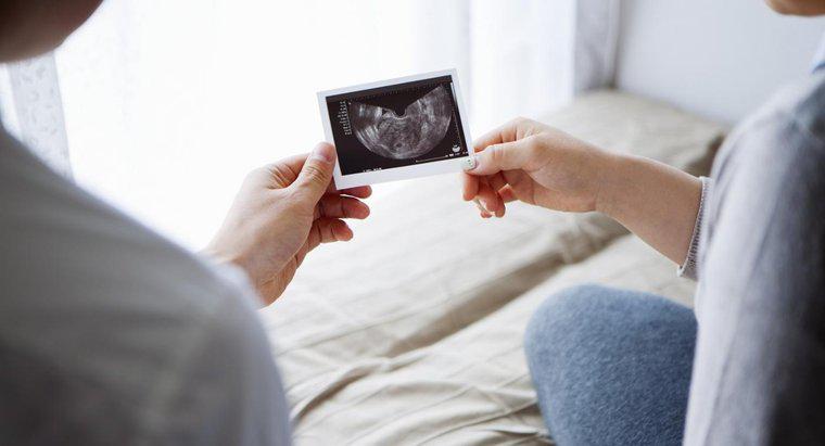 Làm thế nào bạn có thể xác định thai nhi là nam hay nữ?