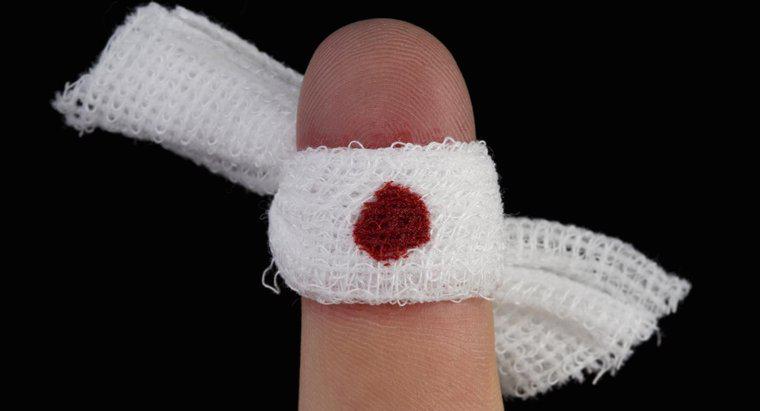 Tại sao ngón tay của tôi không ngừng chảy máu?