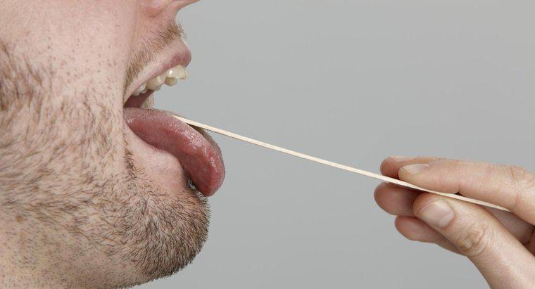 Loại bác sĩ nào phù hợp nhất để điều trị vấn đề về lưỡi?