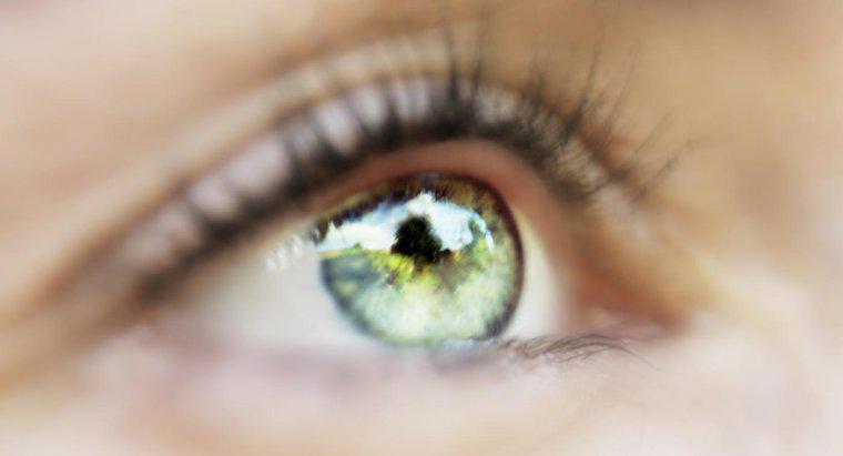 Nguyên nhân nào gây ra hiện tượng nổi nước đen ở mắt?